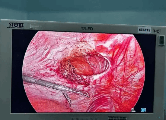 辣妈模仿Ella真空腹肚子练出洞 果然不要轻易模仿